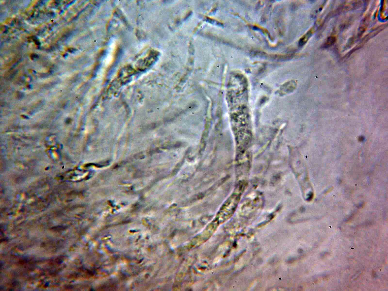 Microscopía de Russula transiens - 10 - Pileocistidio 1